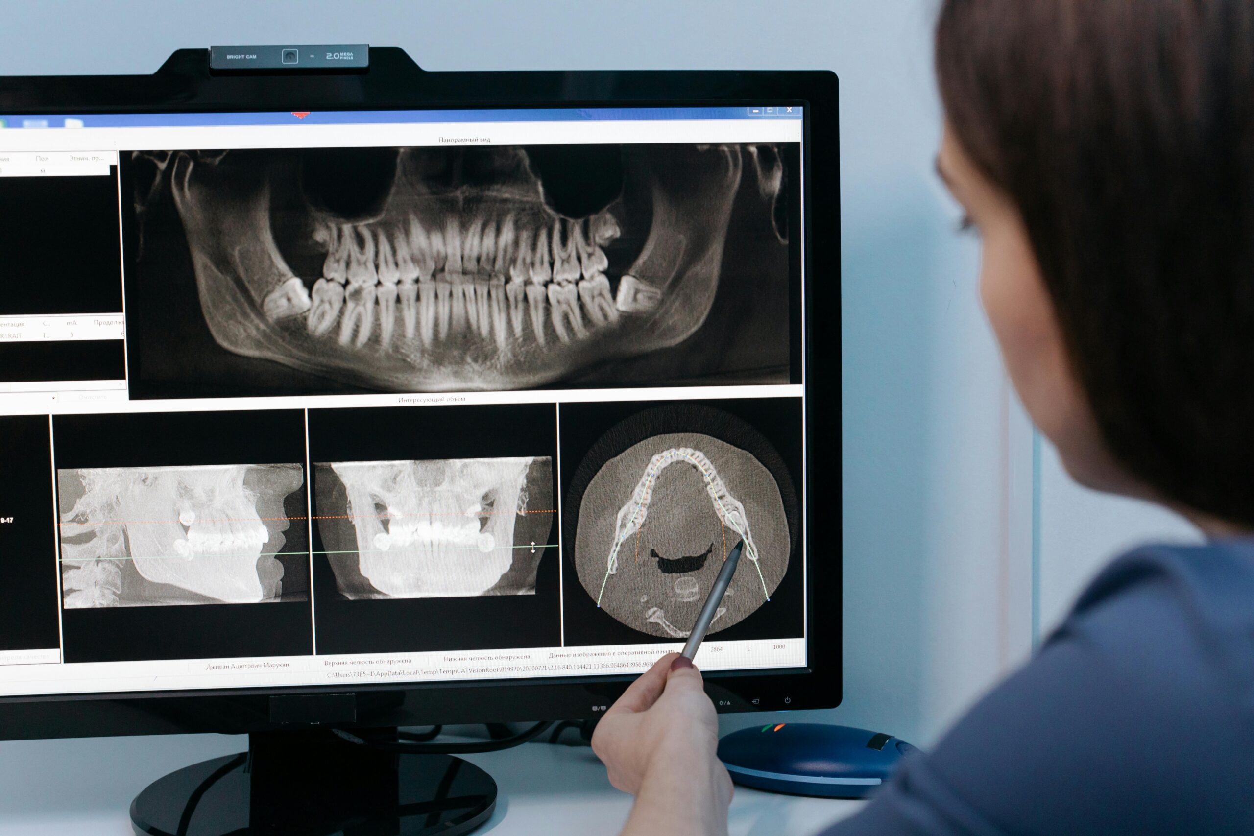 In a modern dentistry office, a person points at a computer monitor displaying dental X-ray images, including a panoramic view of teeth and jaw, essential for diagnosing conditions.